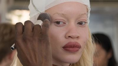 Albinism is just a colour