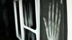 The Incredible Human Hand