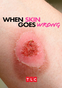 When Skin Goes Wrong