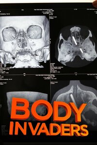 Body Invaders