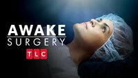 Awake Surgery