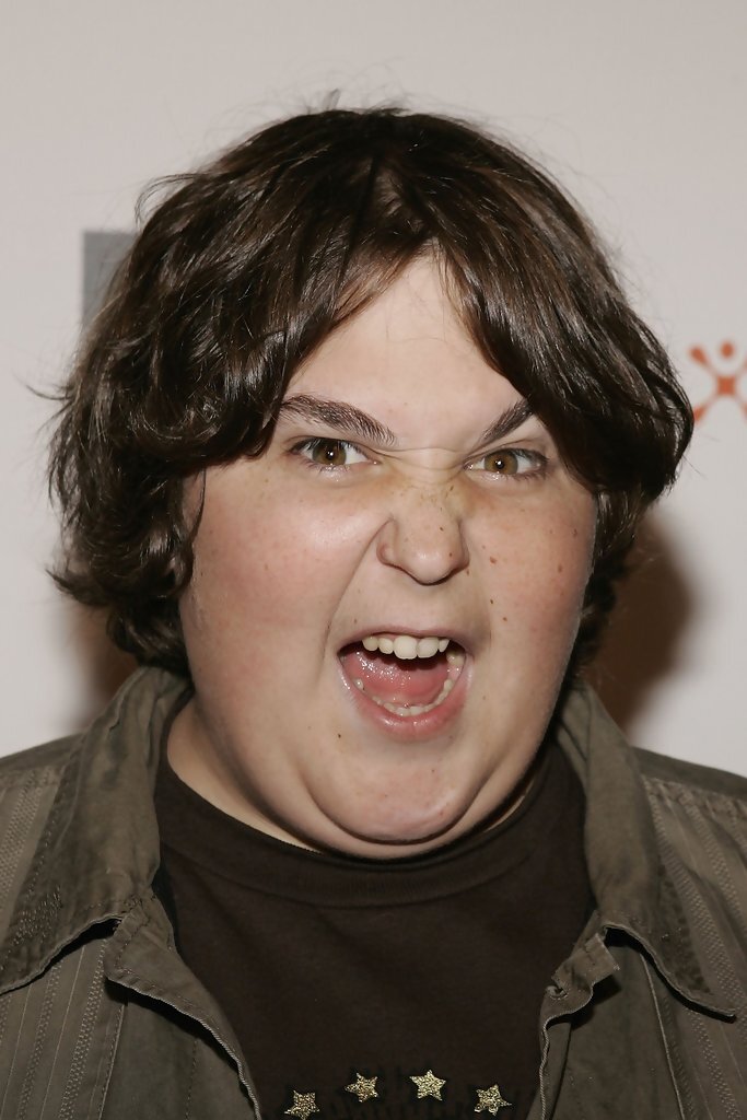 Andy Milonakis Disability